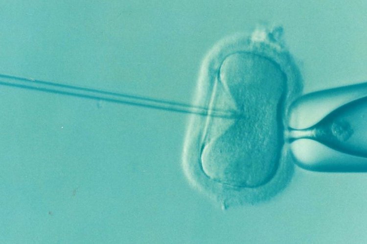 Ma position exprimée sur le projet de loi bioéthique lors de la discussion générale du texte
